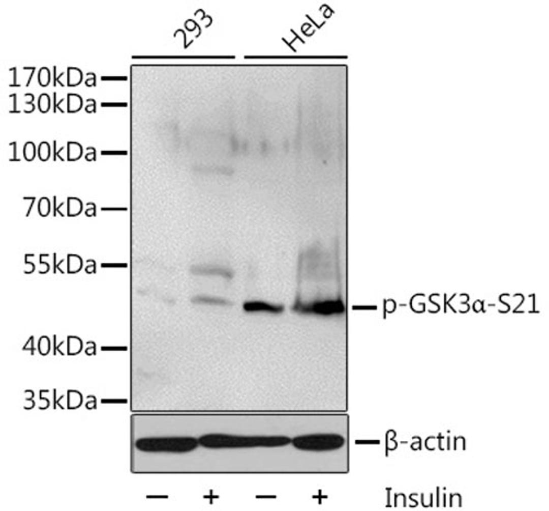 Western blot - Phospho-GSK3a-S21 antibody (AP0582)