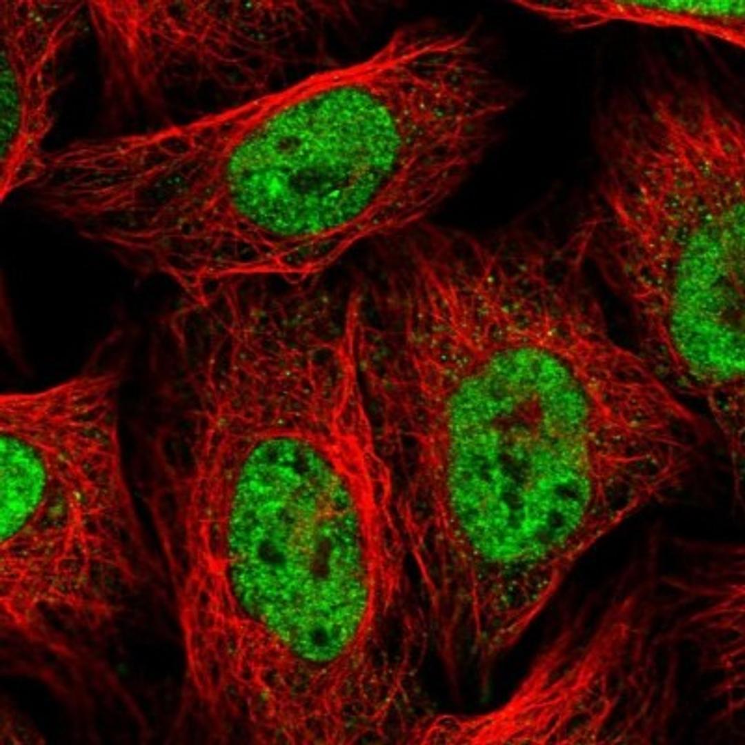 Immunofluorescence: hnRNP AB Antibody [NBP1-91999] - Immunofluorescent staining of human cell line U-2 OS shows positivity in nucleus but not nucleoli.