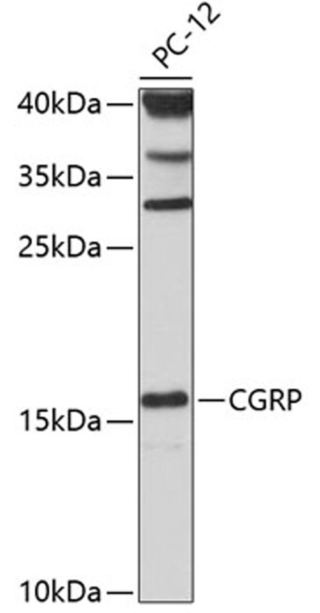 Western blot - CGRP antibody (A5542)