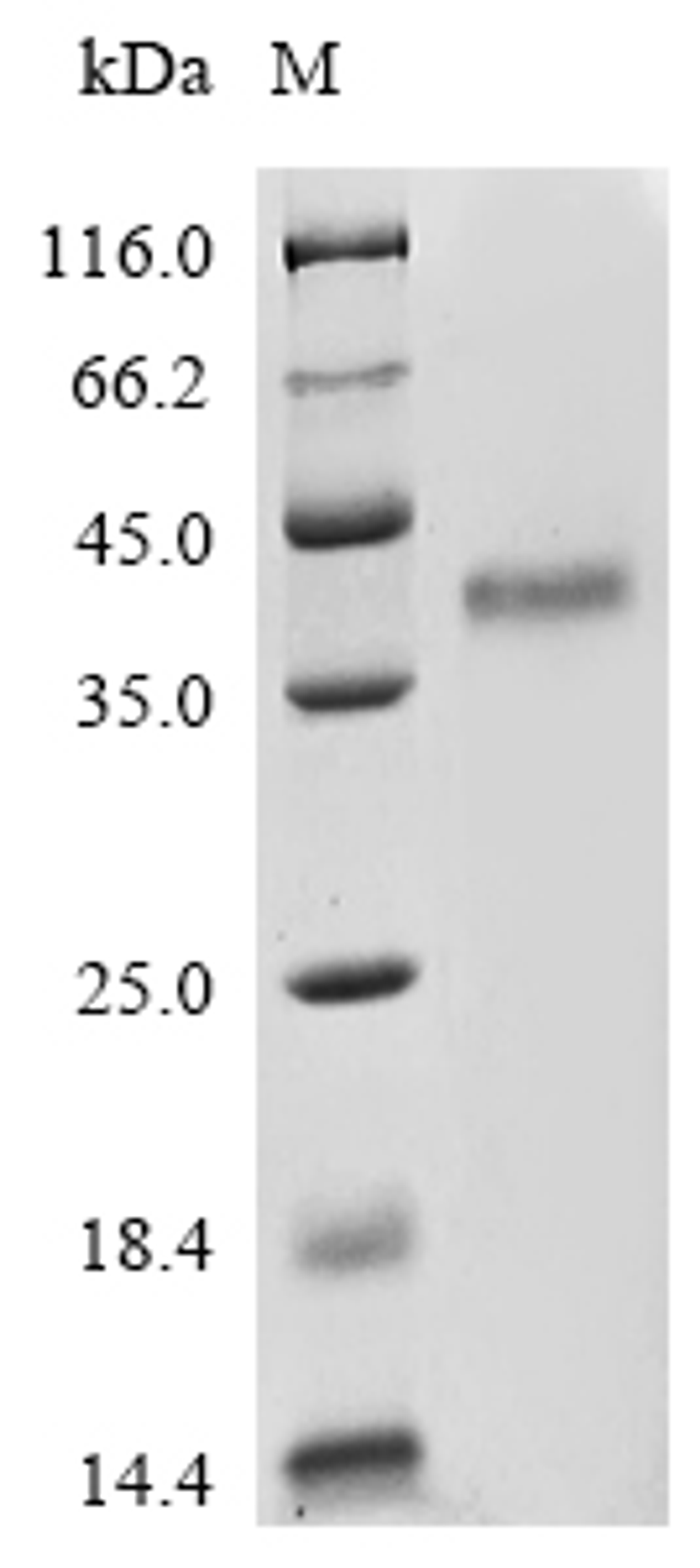 (Tris-Glycine gel) Discontinuous SDS-PAGE (reduced) with 5% enrichment gel and 15% separation gel.