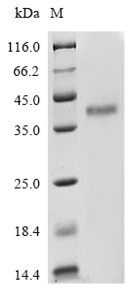(Tris-Glycine gel) Discontinuous SDS-PAGE (reduced) with 5% enrichment gel and 15% separation gel.
