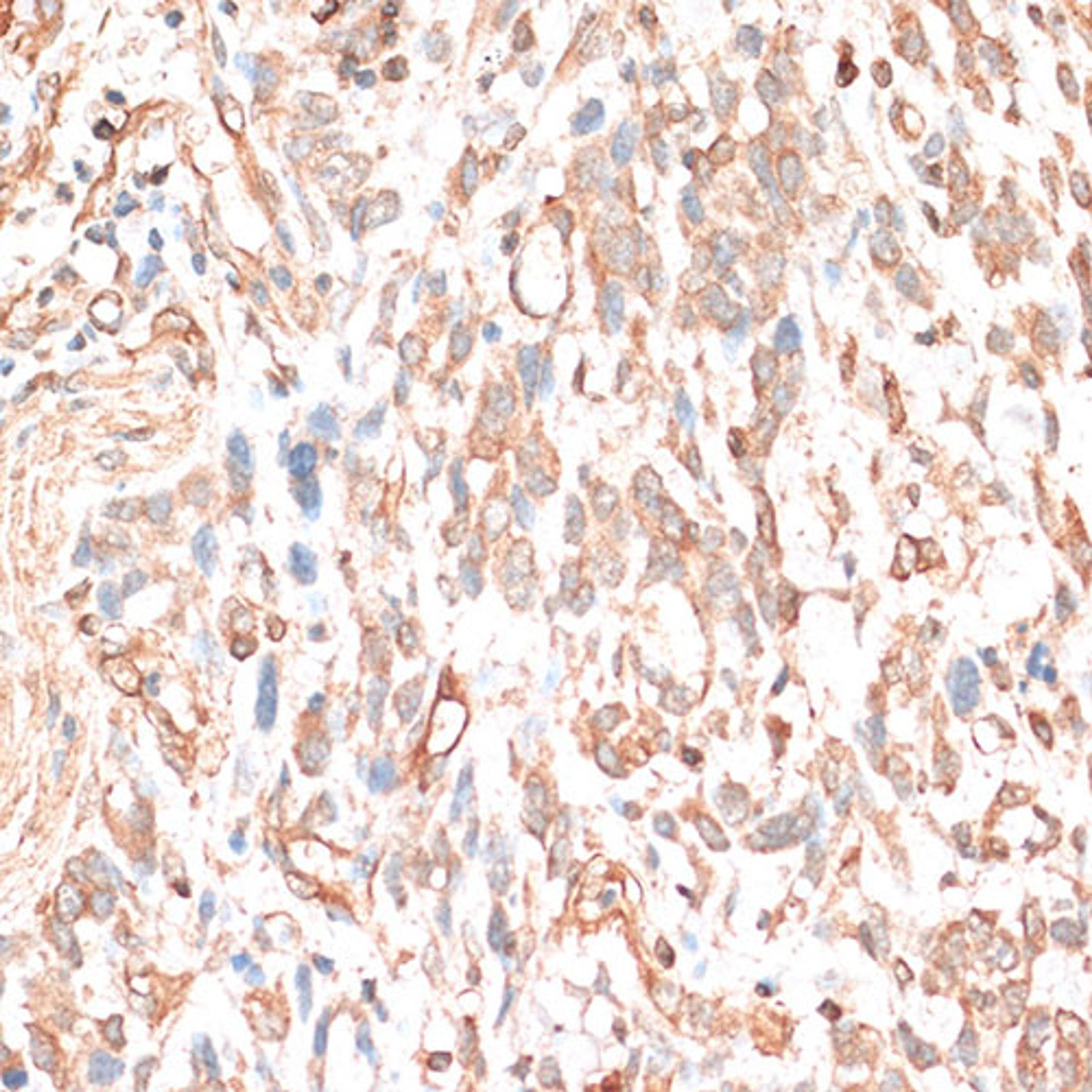 Immunohistochemistry  - CDH11 antibody (A14717)