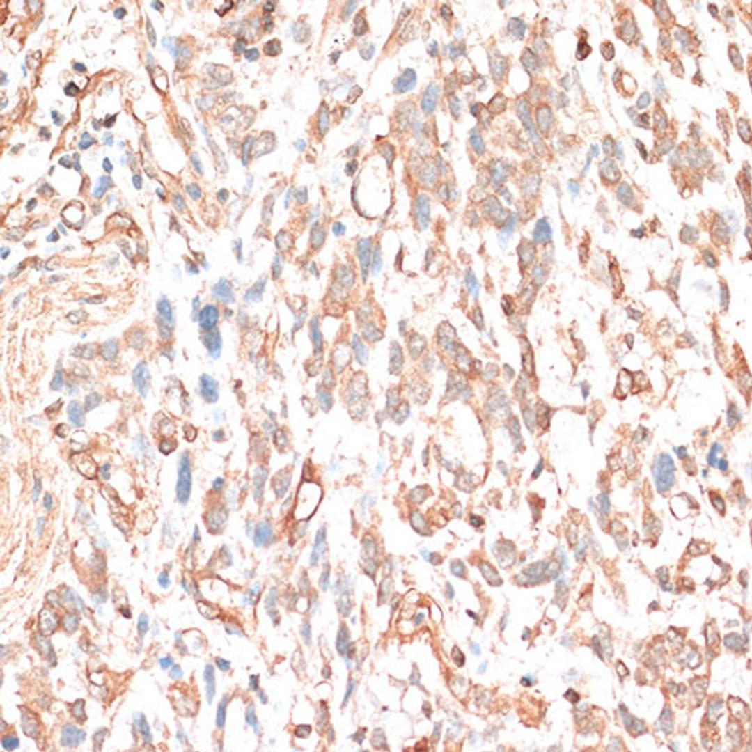 Immunohistochemistry - CDH11 antibody (A14717)