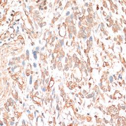 Immunohistochemistry - CDH11 antibody (A14717)