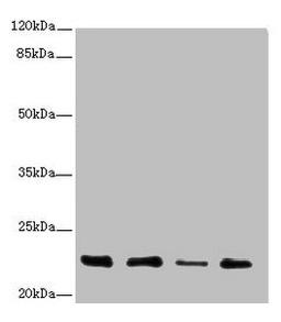 Western blot. All lanes: TNFAIP8 antibody at 2.79µg/ml. Lane 1: A431 whole cell lysate. Lane 2: PC-3 whole cell lysate. Lane 3: Human placenta tissue. Lane 4: Mouse thymus tissue. Secondary. Goat polyclonal to rabbit IgG at 1/10000 dilution. Predicted band size: 24, 23, 22, 25 kDa. Observed band size: 22 kDa