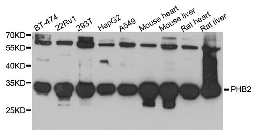 Western blot analysis of extract of various cells using PHB2 antibody