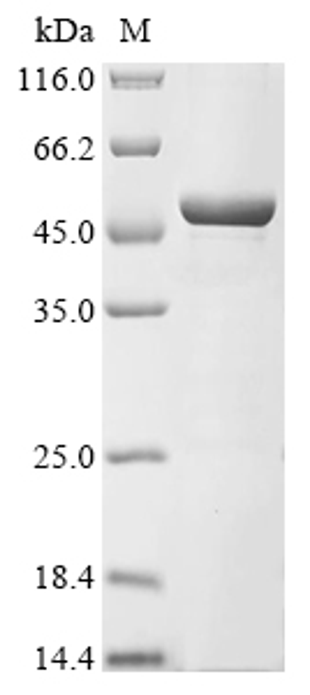 (Tris-Glycine gel) Discontinuous SDS-PAGE (reduced) with 5% enrichment gel and 15% separation gel.