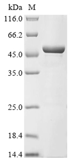 (Tris-Glycine gel) Discontinuous SDS-PAGE (reduced) with 5% enrichment gel and 15% separation gel.