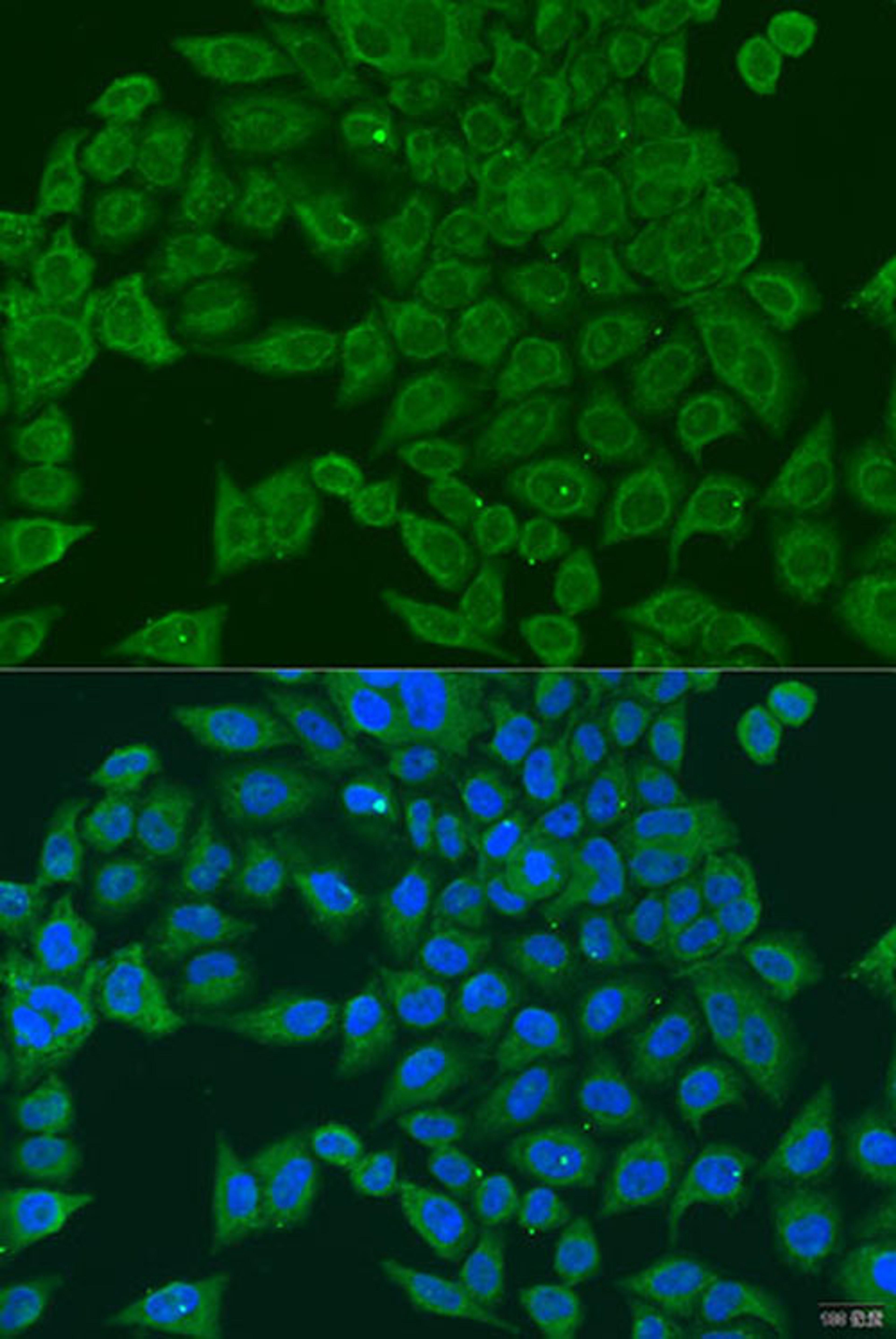 Immunofluorescence - PIWIL1 antibody (A6823)