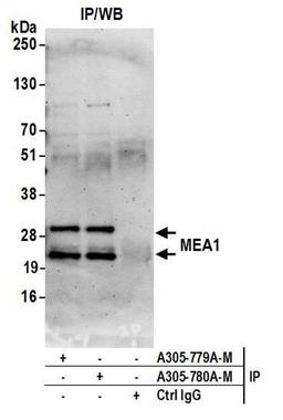 Detection of human MEA1 by WB of IP.