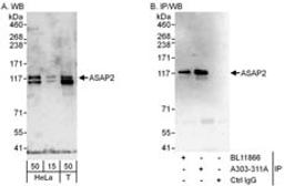 Detection of human ASAP2 by western blot and immunoprecipitation.