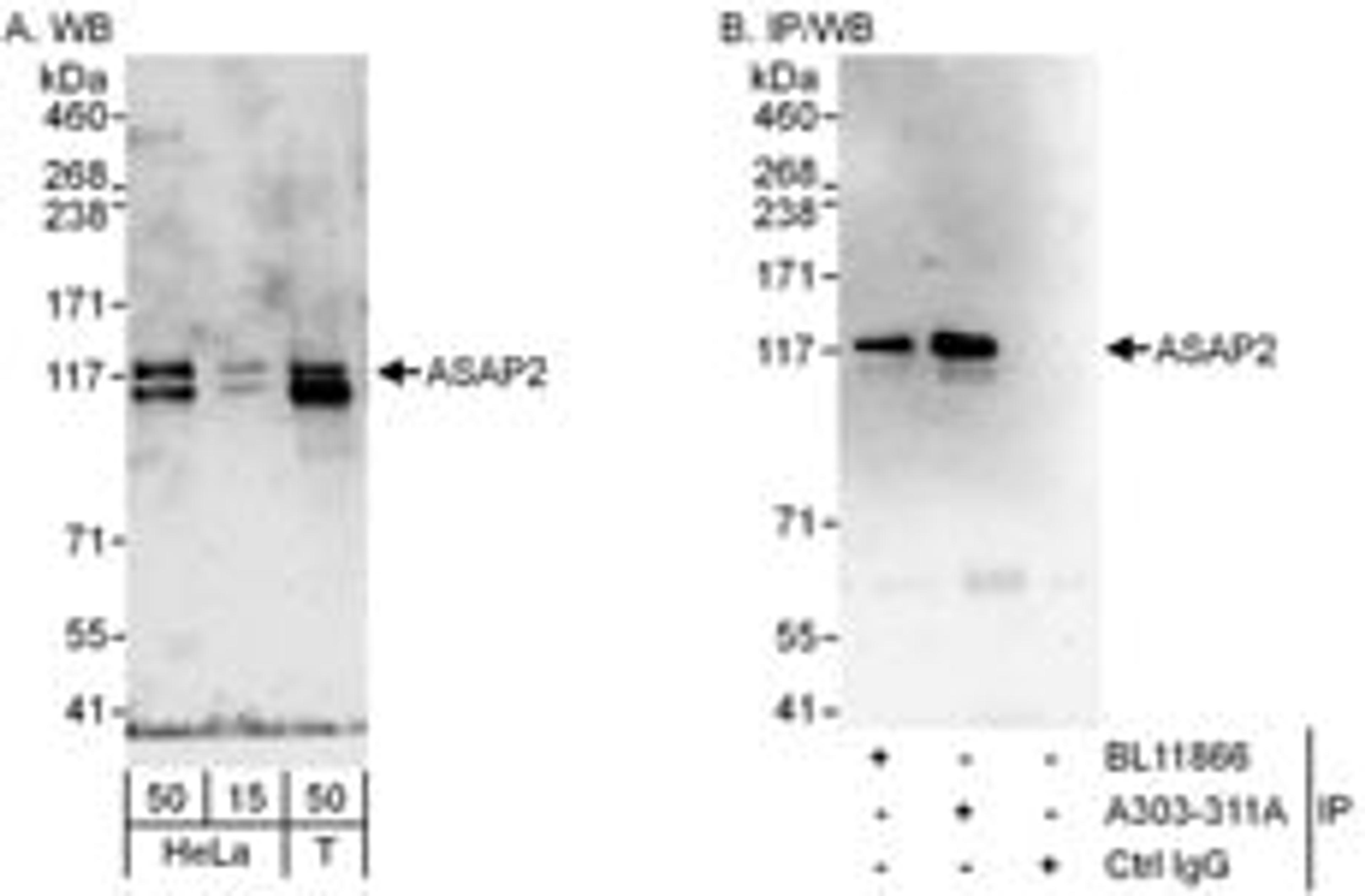 Detection of human ASAP2 by western blot and immunoprecipitation.