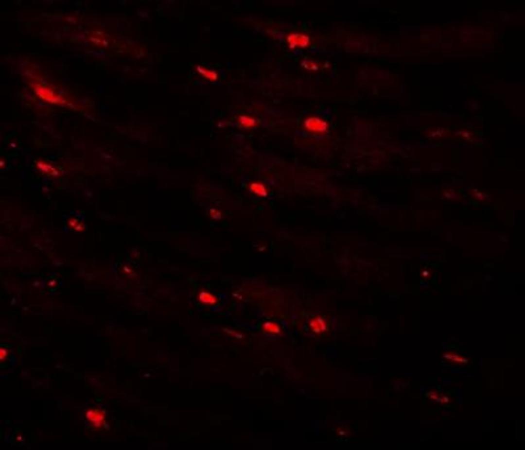 Immunocytochemistry/Immunofluorescence: MTUS2 Antibody [NBP1-77130] - Immunofluorescence of CAZIP in mouse heart tissue with CAZIP antibody at 20 ug/mL.