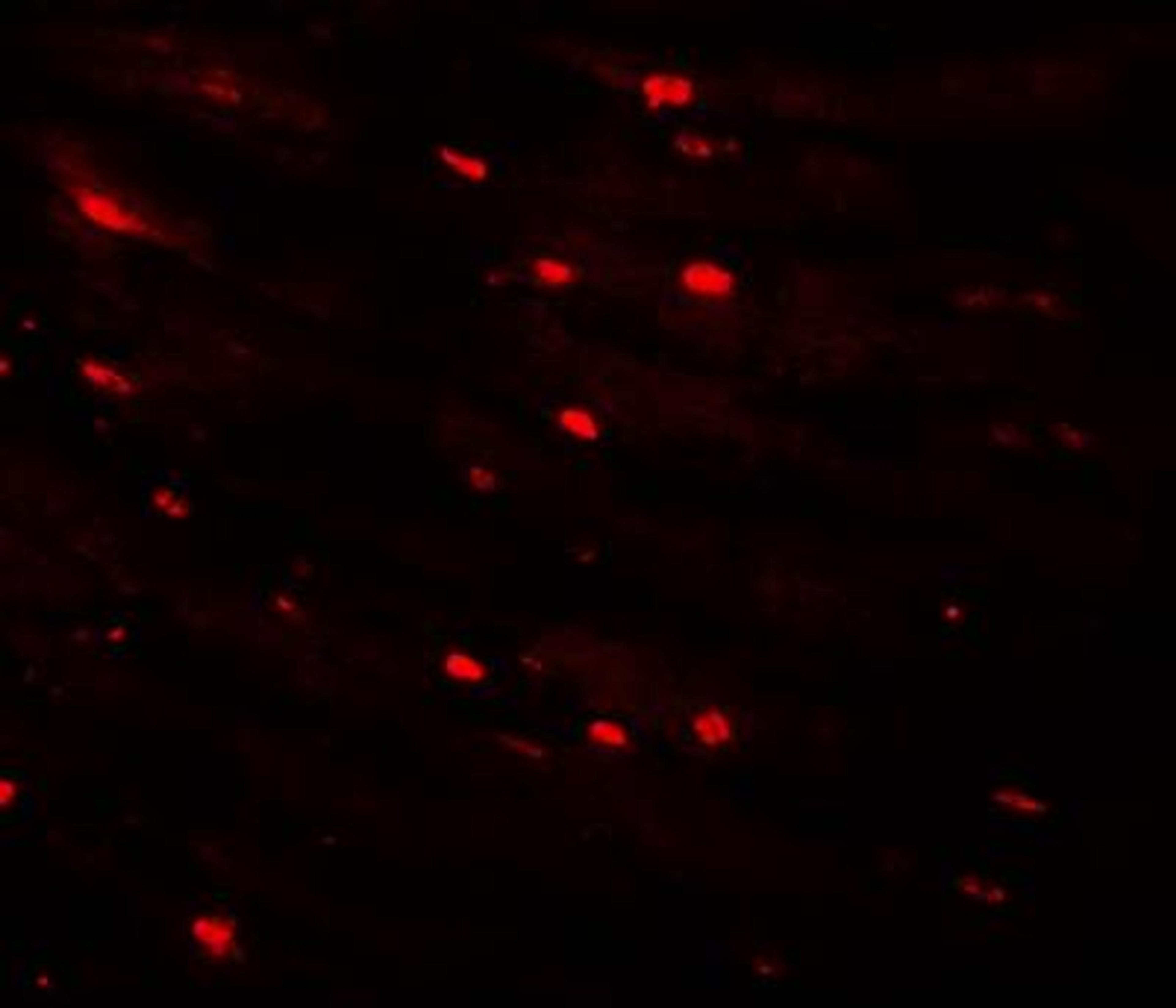 Immunocytochemistry/Immunofluorescence: MTUS2 Antibody [NBP1-77130] - Immunofluorescence of CAZIP in mouse heart tissue with CAZIP antibody at 20 ug/mL.