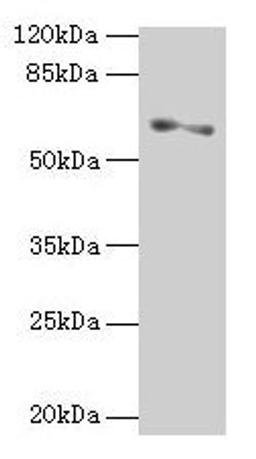 Western blot. All lanes: SLC1A6 antibody at 2µg/ml + A375 whole cell lysate. Secondary. Goat polyclonal to rabbit IgG at 1/10000 dilution. Predicted band size: 62, 35 kDa. Observed band size: 62 kDa