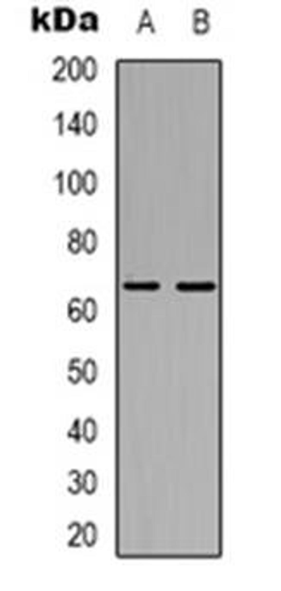 Western blot analysis of SPAK expression in Jurkat (Lane 1), HepG2 (Lane 2) whole cell lysates using STK39 antibody