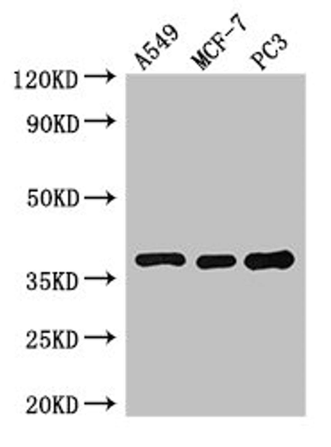 Western Blot. Positive WB detected in: A549 whole cell lysate, MCF-7 whole cell lysate, PC-3 whole cell lysate. All lanes: SLC9A3R2 antibody at 3ug/ml. Secondary. Goat polyclonal to rabbit IgG at 1/50000 dilution. Predicted band size: 38, 37, 25 kDa. Observed band size: 38 kDa. 