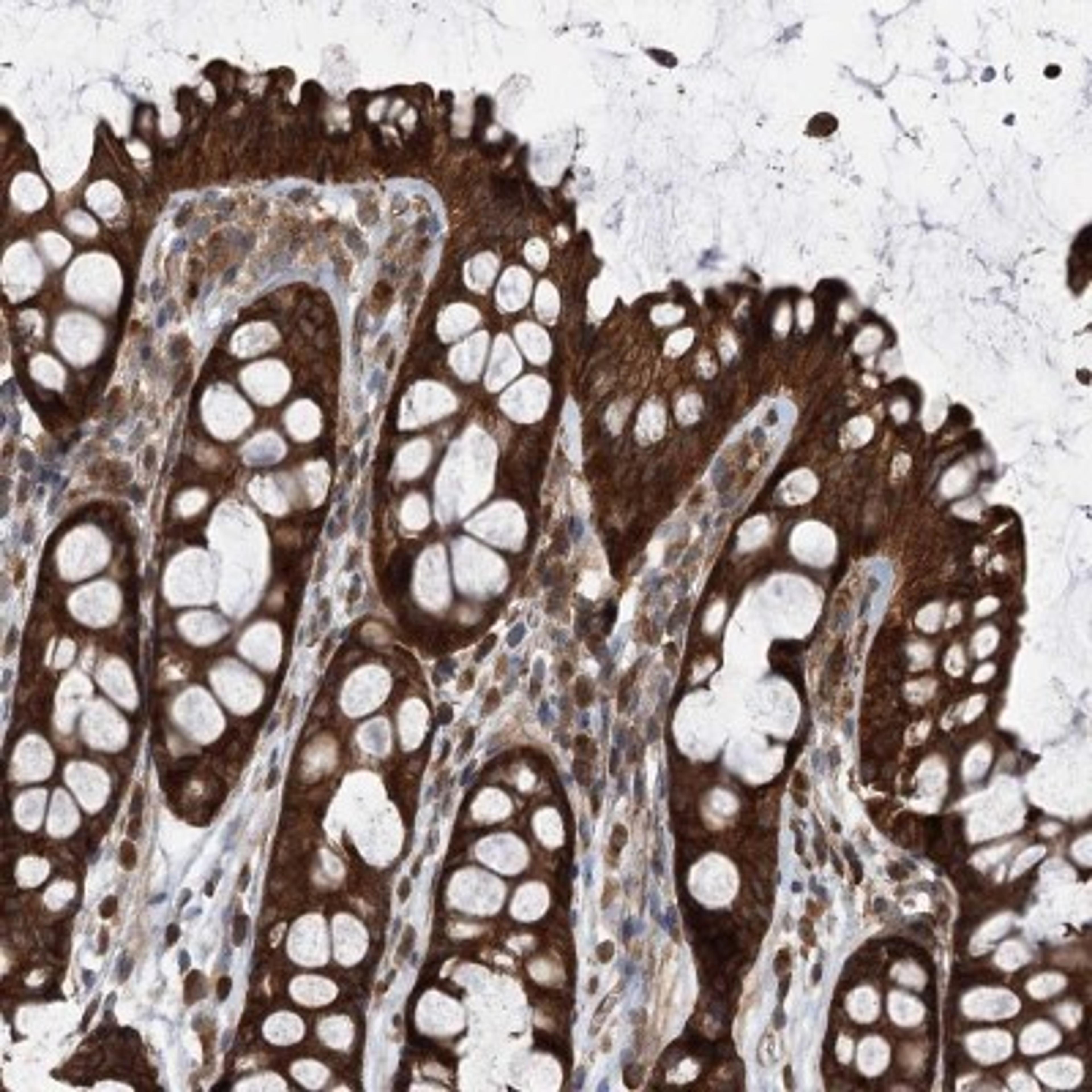 Immunohistochemistry-Paraffin: VPS37B Antibody [NBP1-82283] - Staining of human colon shows strong cytoplasmic positivity in glandular cells.