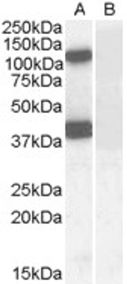 45-541 (0.1ug/ml) staining of Human Brain (Cerebellum) lysate (35ug protein in RIPA buffer) with (B) and without (A) blocking with the immunising peptide. Primary incubation was 1 hour. Detected by chemiluminescence.