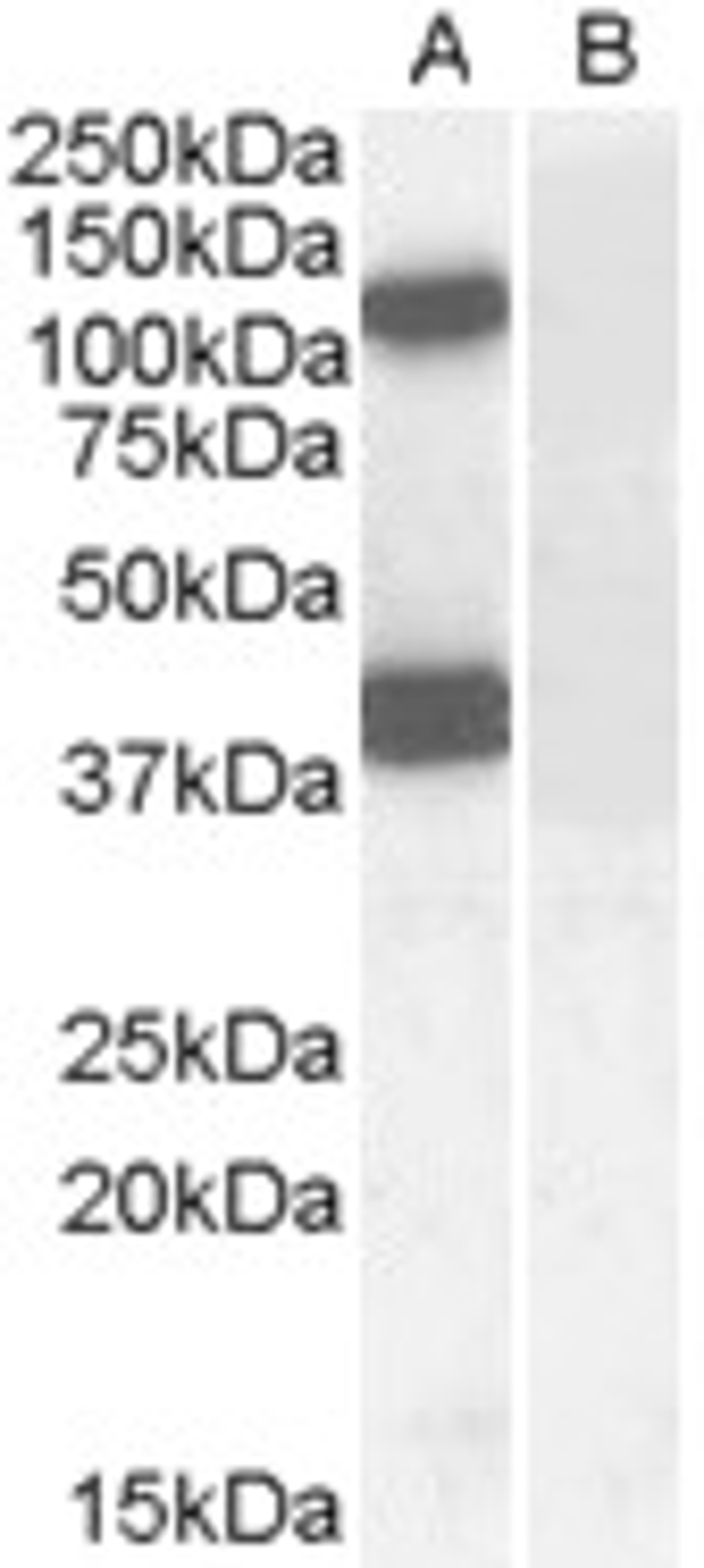 45-541 (0.1ug/ml) staining of Human Brain (Cerebellum) lysate (35ug protein in RIPA buffer) with (B) and without (A) blocking with the immunising peptide. Primary incubation was 1 hour. Detected by chemiluminescence.