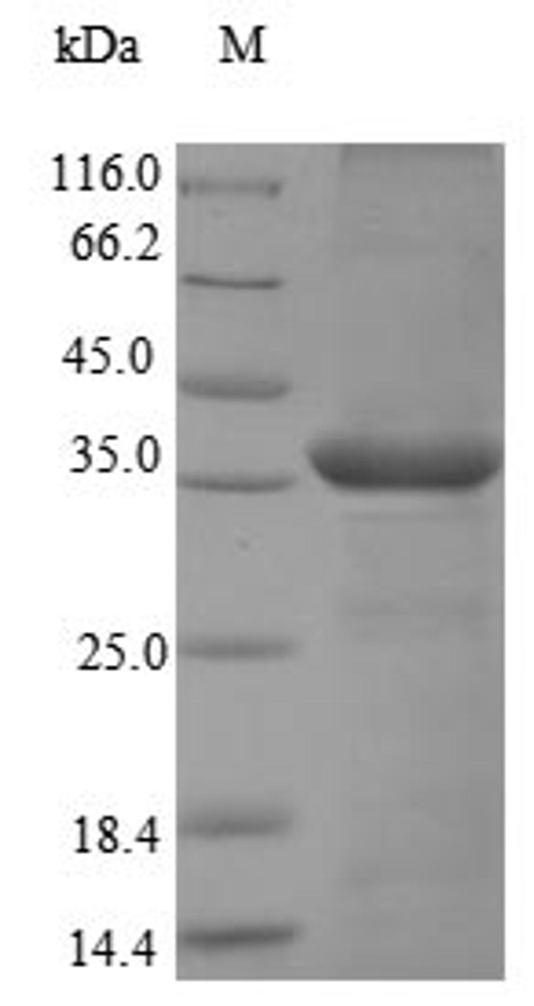 (Tris-Glycine gel) Discontinuous SDS-PAGE (reduced) with 5% enrichment gel and 15% separation gel.