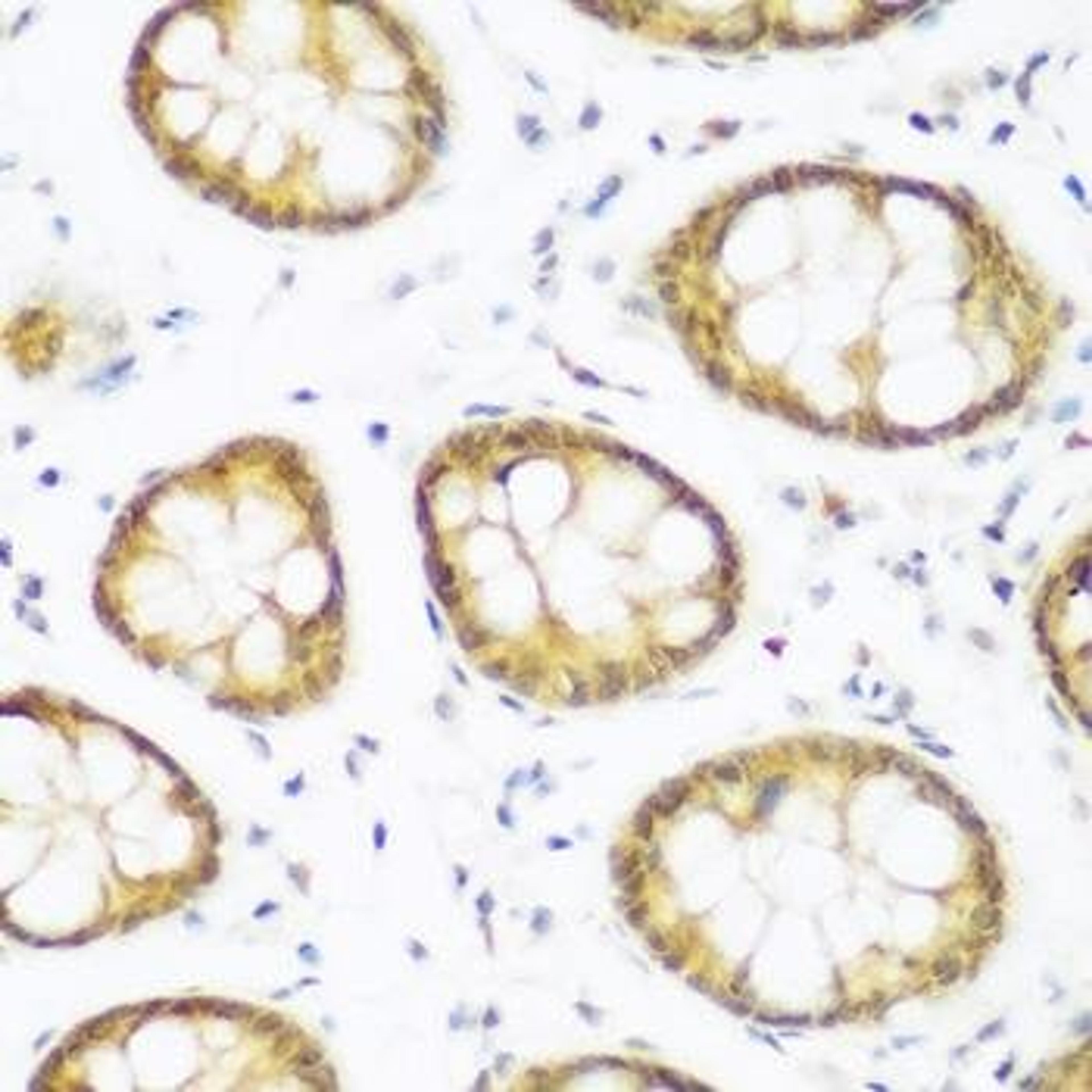 Immunohistochemical staining of human liver tissue using BRD9 antibody (dilution of 1:200)