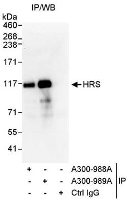 Detection of human HRS by western blot of immunoprecipitates.