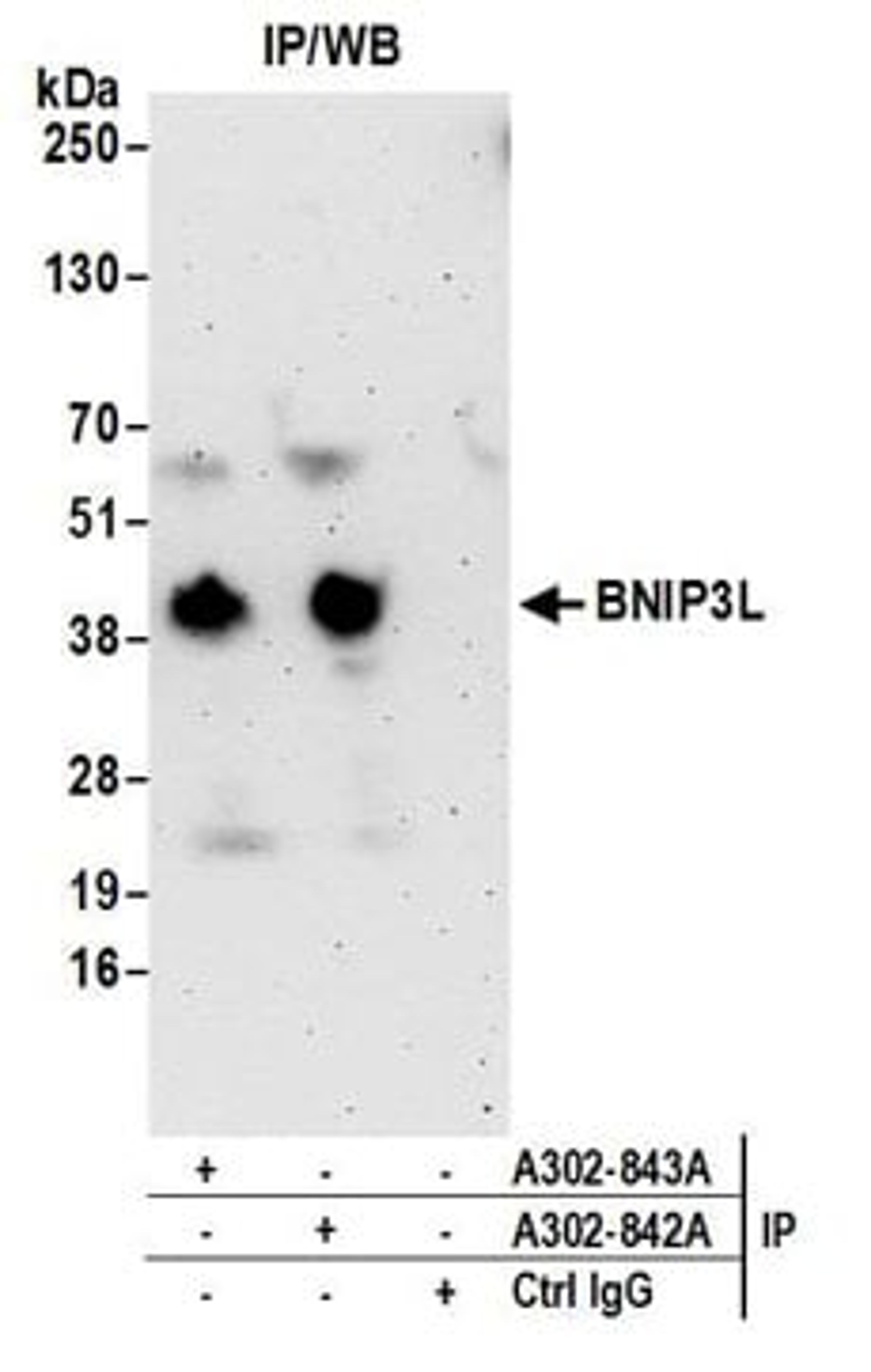 Detection of human BNIP3L by western blot of immunoprecipitates.