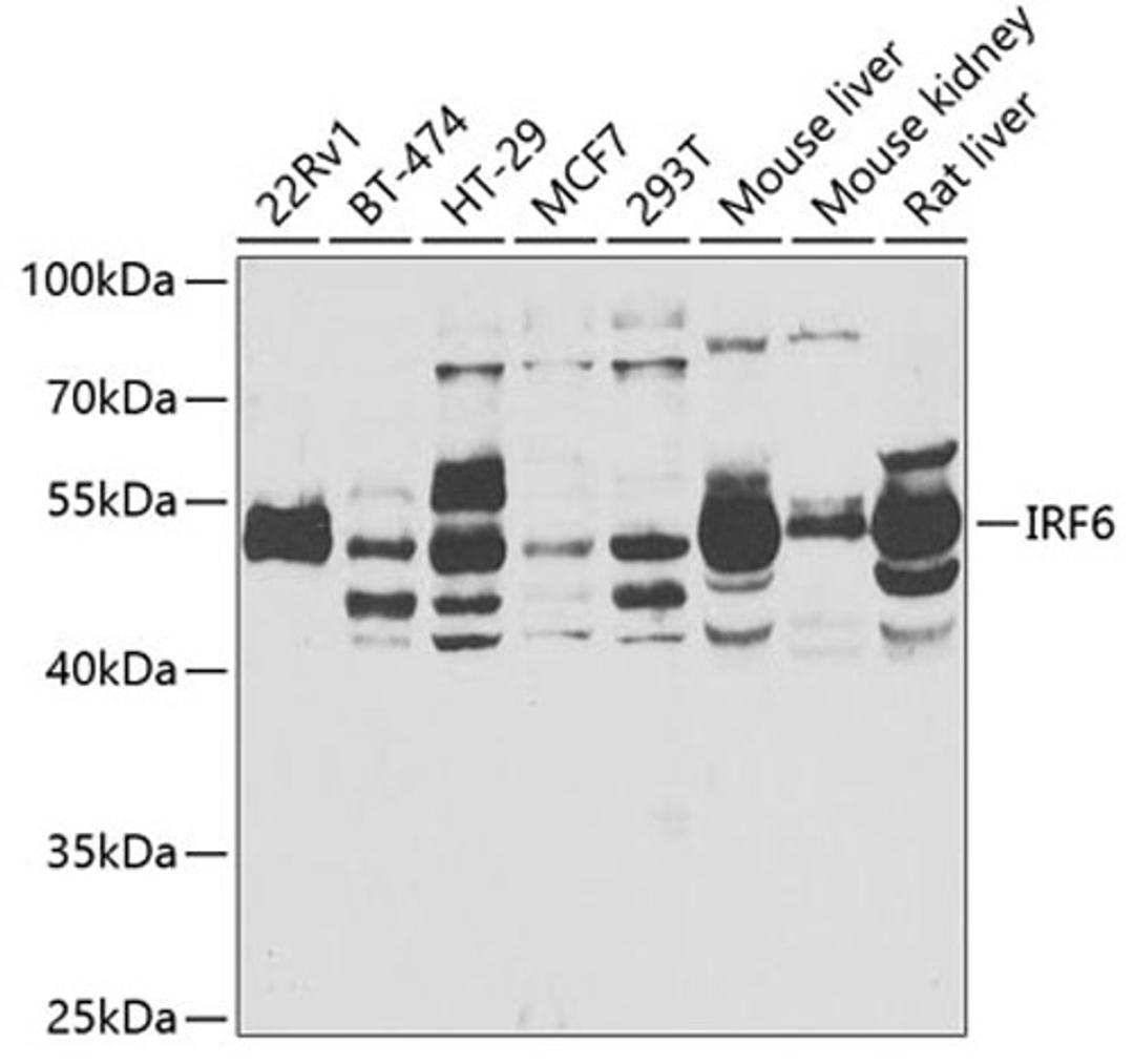 Western blot - IRF6 antibody (A6246)