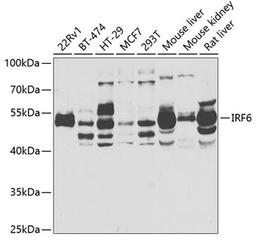 Western blot - IRF6 antibody (A6246)