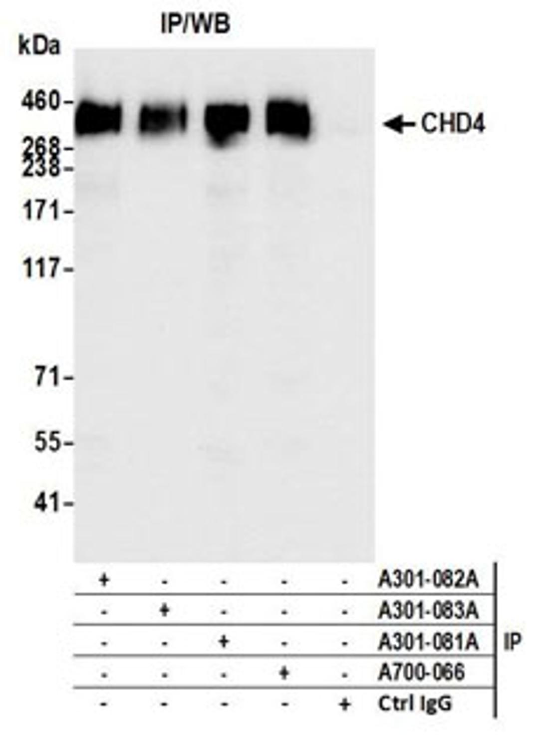 Detection of human CHD4 by western blot of immunoprecipitates.