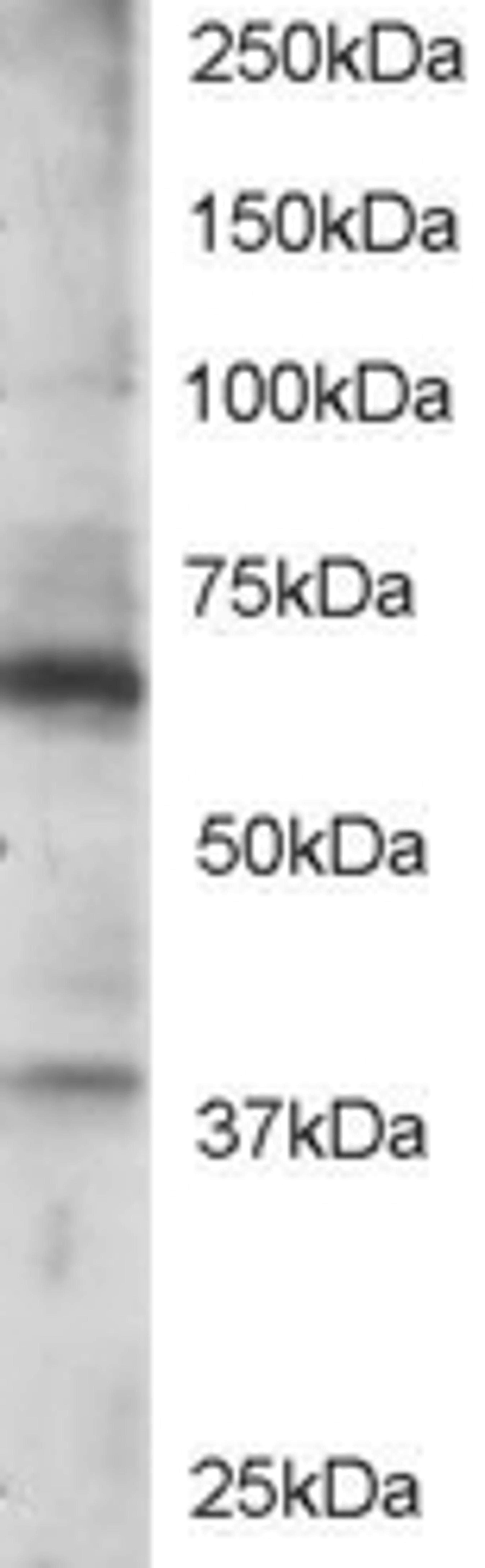 46-288 staining (0.5ug/ml) of Jurkat lysate (RIPA buffer, 35ug total protein per lane). Primary incubated for 1 hour. Detected by western blot using chemiluminescence.