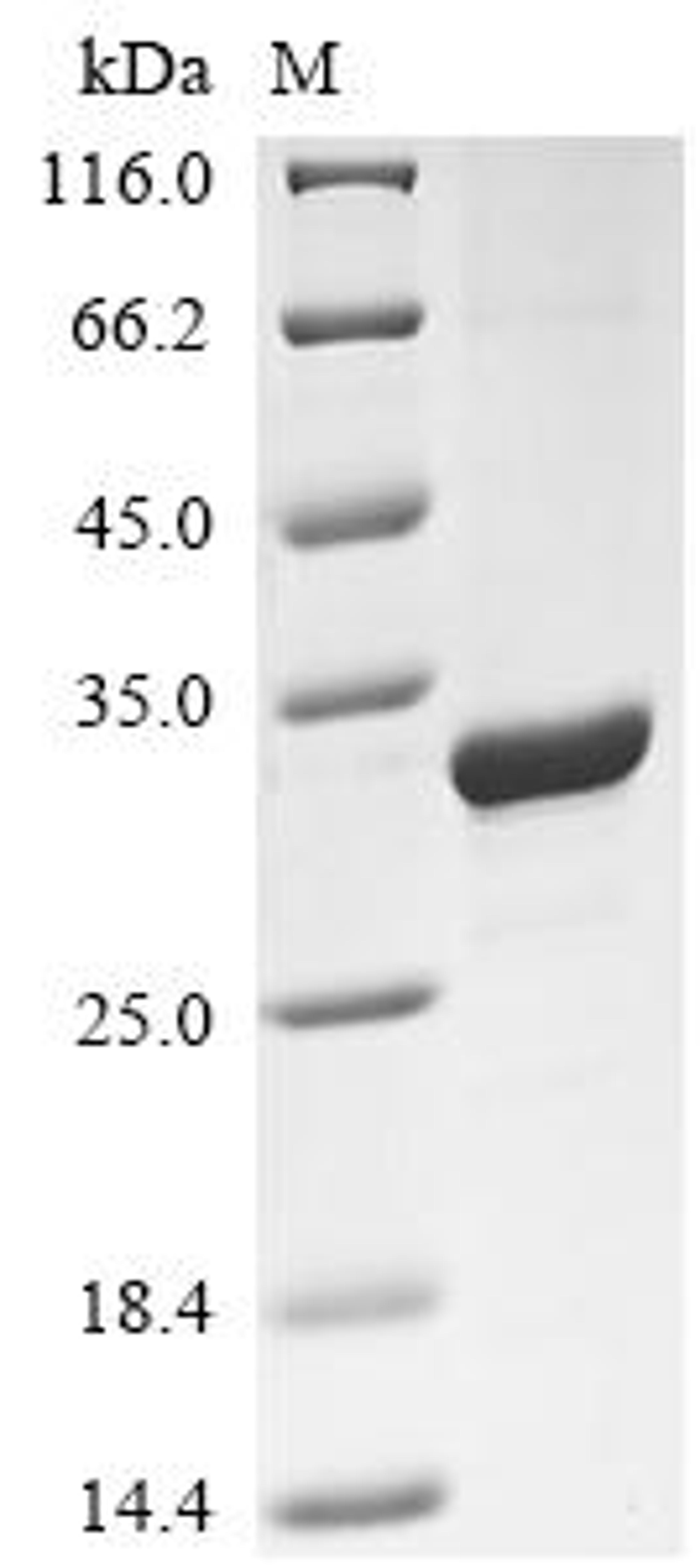 (Tris-Glycine gel) Discontinuous SDS-PAGE (reduced) with 5% enrichment gel and 15% separation gel.