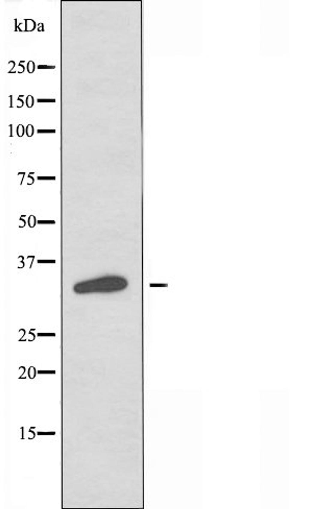 Western blot analysis of LOVO cells and HT-29 cells using OR4A4/47 antibody