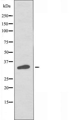 Western blot analysis of LOVO cells and HT-29 cells using OR4A4/47 antibody