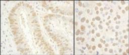 Detection of human and mouse GTF2E1/TFIIE-alpha by immunohistochemistry.