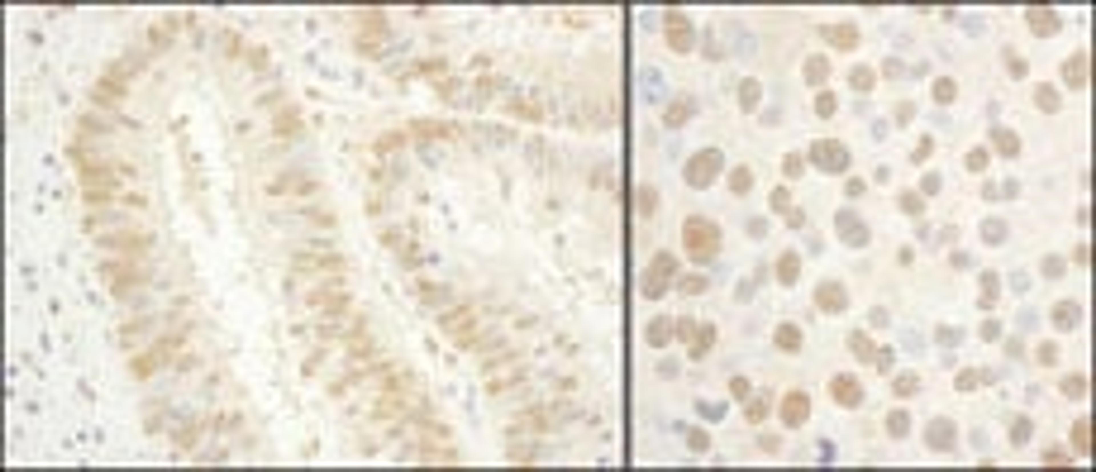 Detection of human and mouse GTF2E1/TFIIE-alpha by immunohistochemistry.