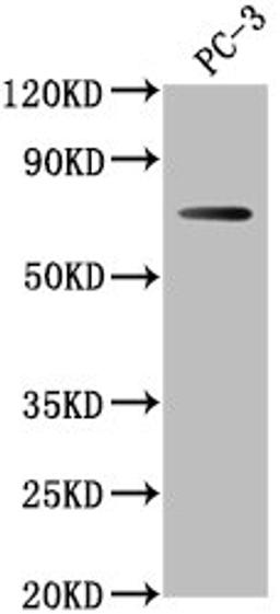 Western Blot. Positive WB detected in: PC-3 whole cell lysate. All lanes: DVL1P1 antibody at 1:1000. Secondary. Goat polyclonal to rabbit IgG at 1/50000 dilution. Predicted band size: 74, 73 kDa. Observed band size: 74 kDa.