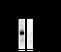 Western blot of rat hippocampal lysate showing phospho-specific immunolabeling of the ~100k GluR1 protein phosphorylated at Ser845.