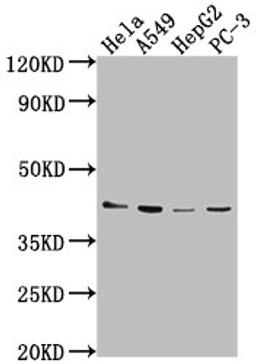 Western Blot. Positive WB detected in: Hela whole cell lysate, A549 whole cell lysate, HepG2 whole cell lysate, PC-3 whole cell lysate. All lanes: LPAR6 antibody at 1:2000. Secondary. Goat polyclonal to rabbit IgG at 1/50000 dilution. Predicted band size: 40 kDa. Observed band size: 40 kDa. 