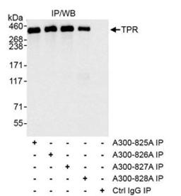 Detection of human TPR by western blot of immunoprecipitates.