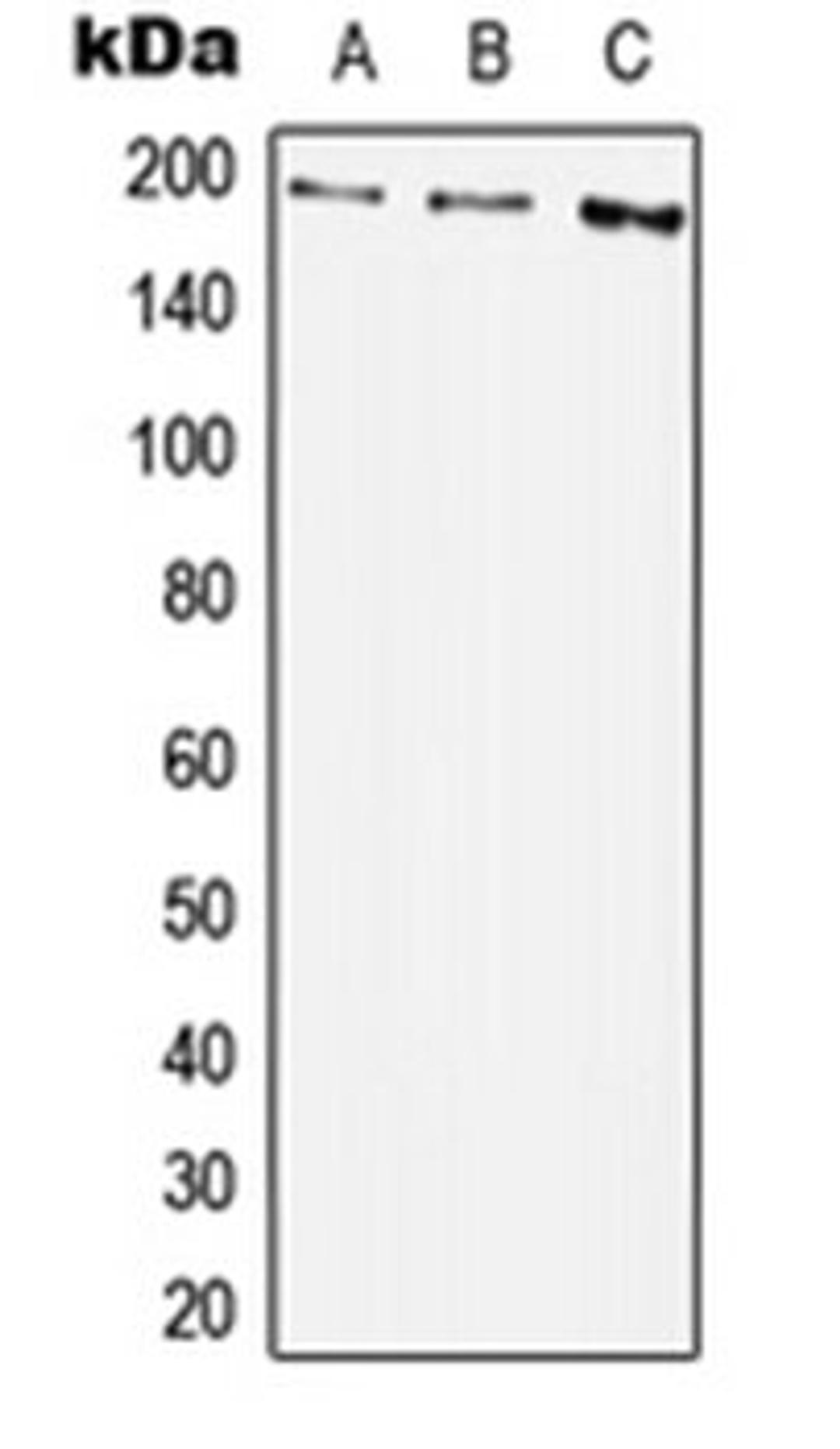 Western blot analysis of A549 (Lane 1), Raw264.7 (Lane 2), PC12 (Lane 3) whole cell lysates using PDGFRB antibody