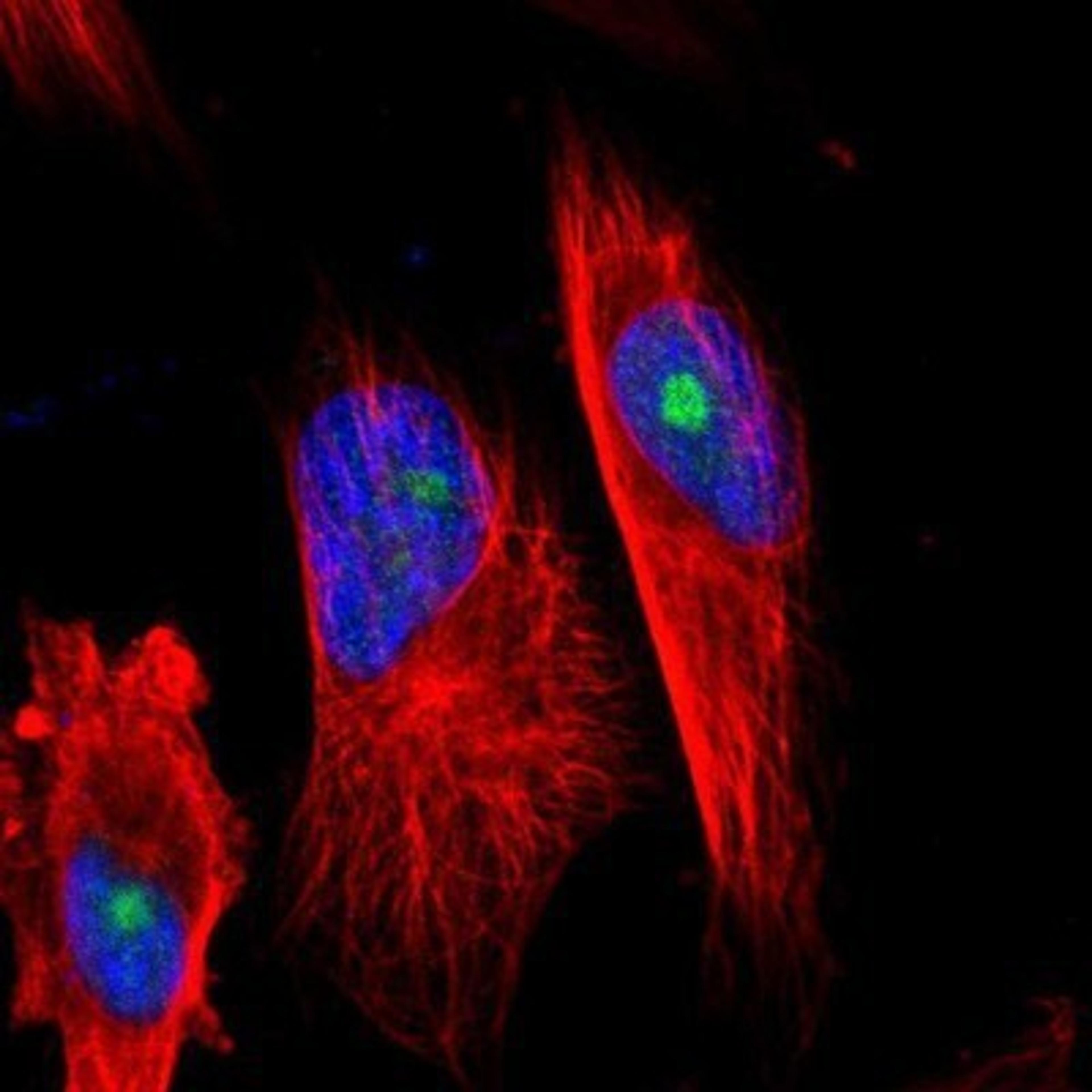 Immunocytochemistry/Immunofluorescence: PNK Antibody [NBP1-87257] - Staining of human cell line U-251MG shows positivity in nucleoli.