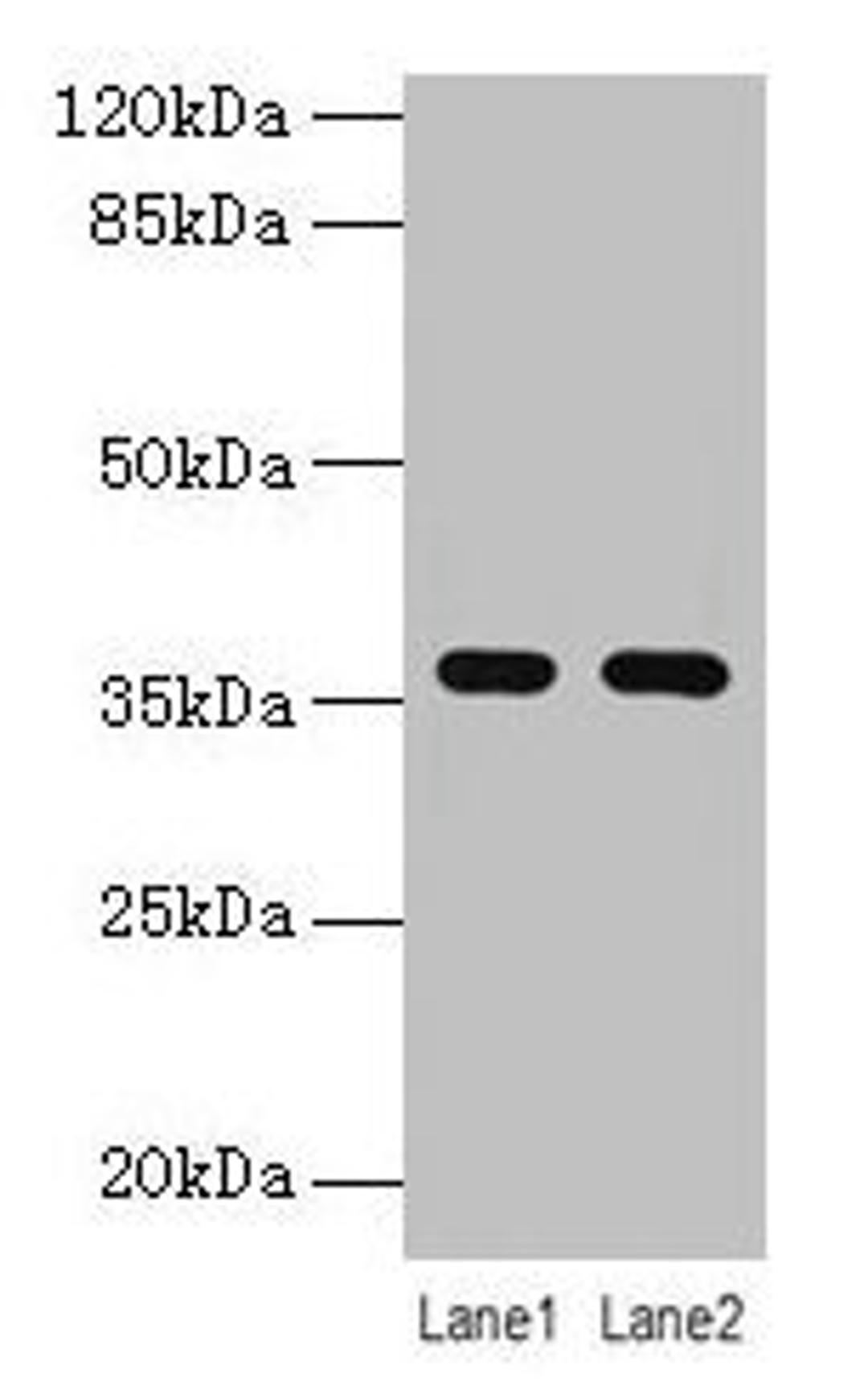 Western blot. All lanes: LYPD3 antibody at 4µg/ml. Lane 1: MCF-7 whole cell lysate. Lane 2: Mouse stomach tissue. Secondary. Goat polyclonal to rabbit IgG at 1/10000 dilution. Predicted band size: 36 kDa. Observed band size: 36 kDa