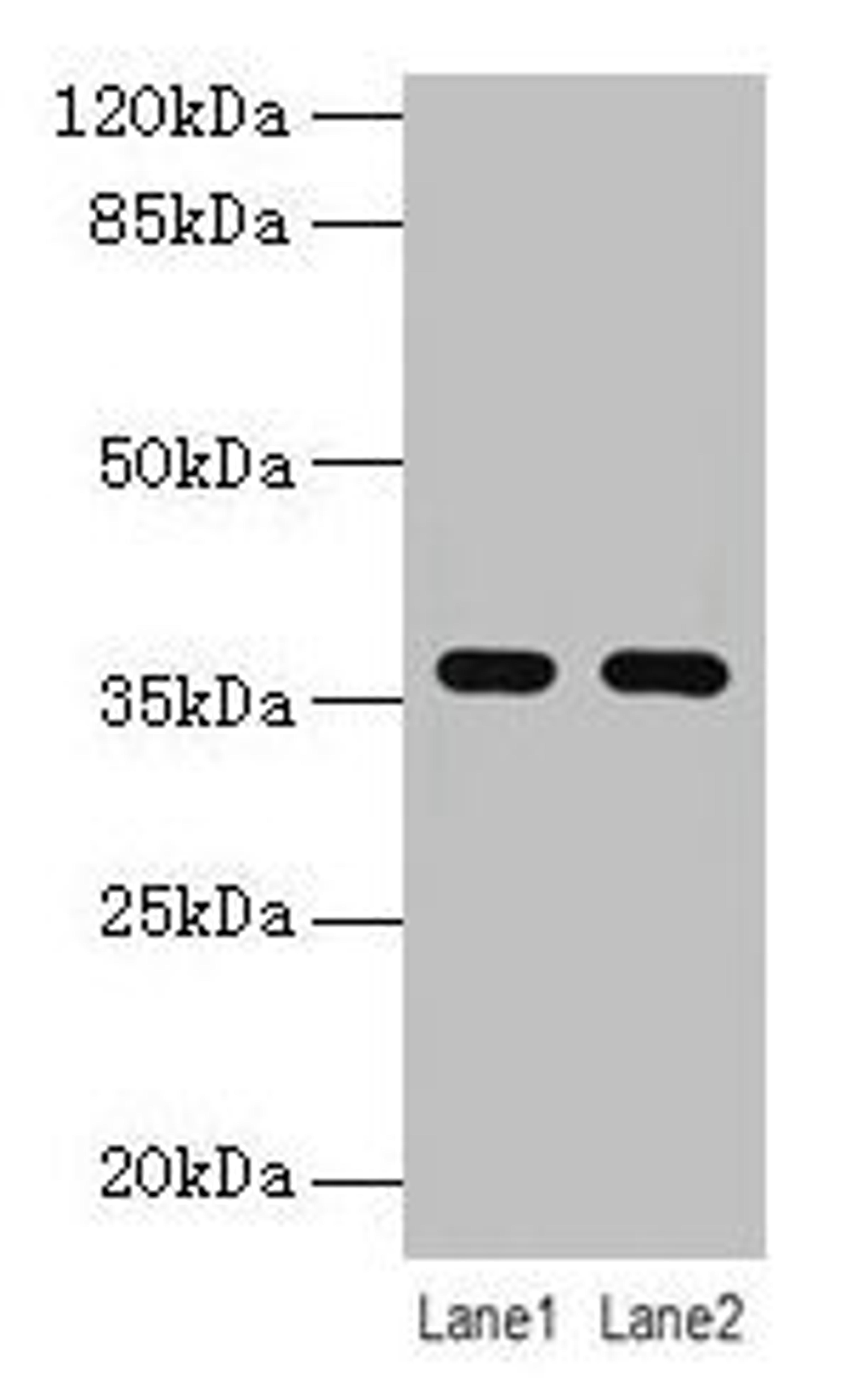Western blot. All lanes: LYPD3 antibody at 4µg/ml. Lane 1: MCF-7 whole cell lysate. Lane 2: Mouse stomach tissue. Secondary. Goat polyclonal to rabbit IgG at 1/10000 dilution. Predicted band size: 36 kDa. Observed band size: 36 kDa