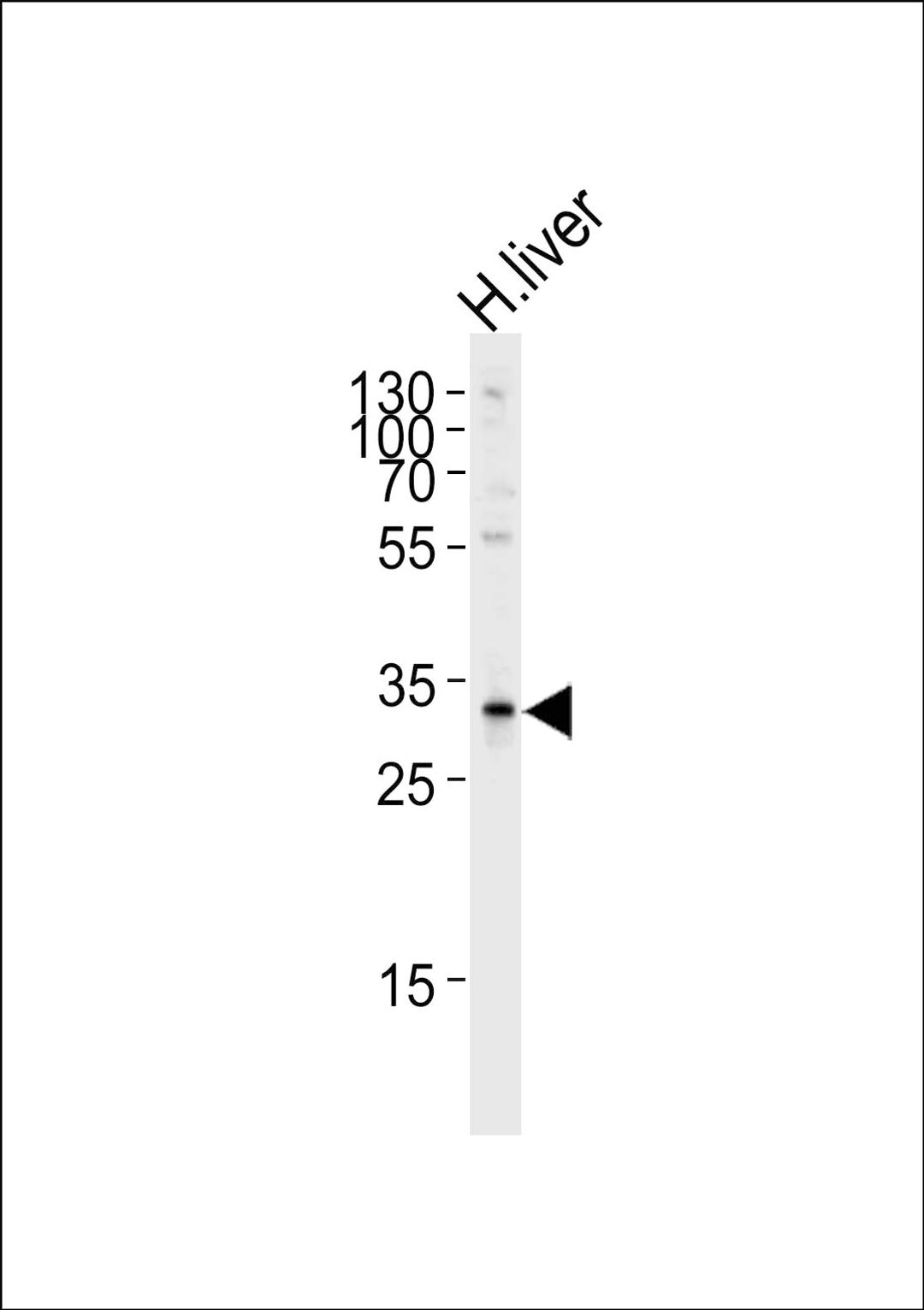 Western blot analysis of lysate from human liver tissue lysate, using SULT2A Antibody (K268) at 1:1000 at each lane.