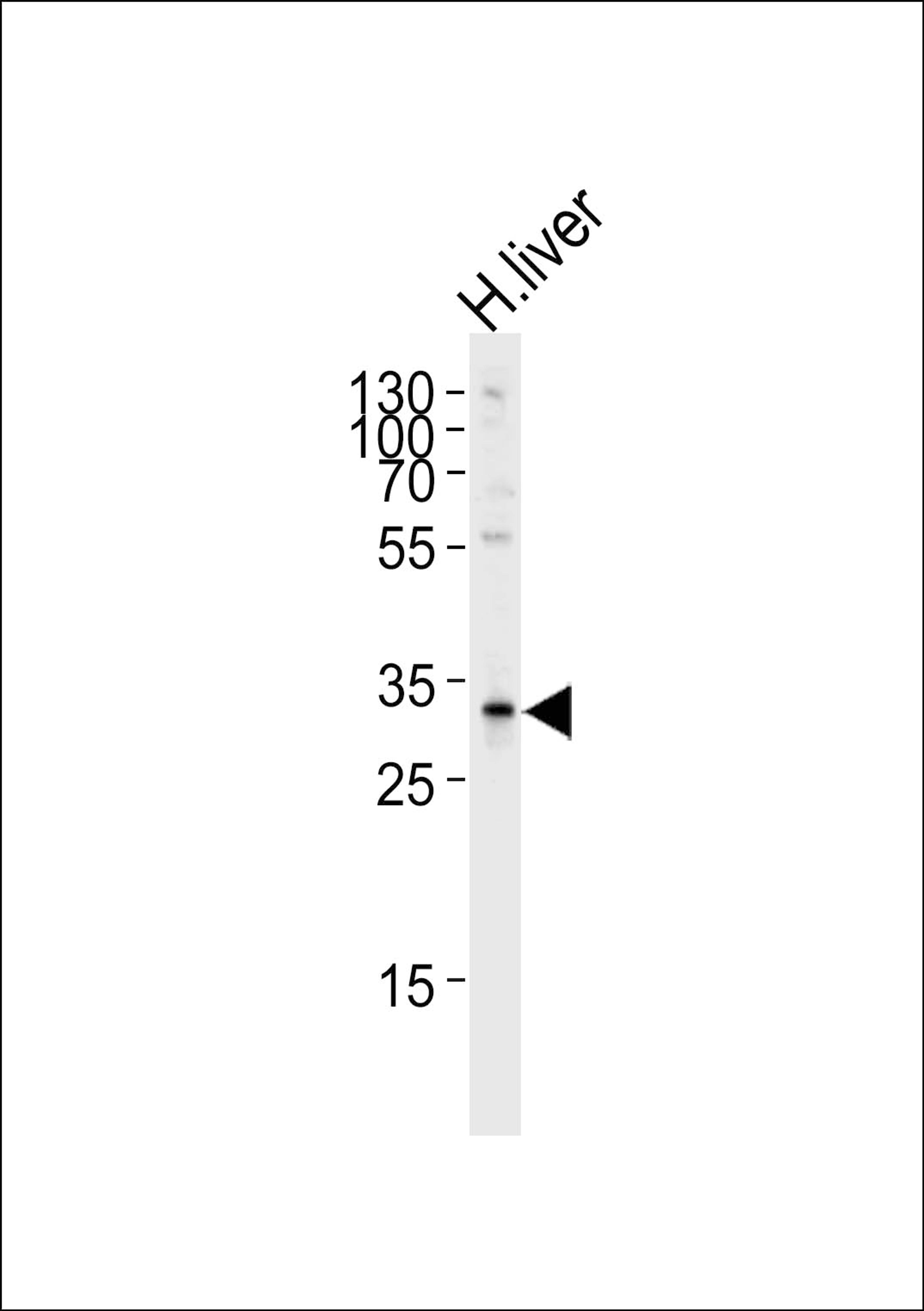 Western blot analysis of lysate from human liver tissue lysate, using SULT2A Antibody (K268) at 1:1000 at each lane.