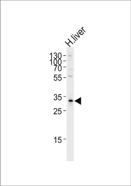 Western blot analysis of lysate from human liver tissue lysate, using SULT2A Antibody (K268) at 1:1000 at each lane.