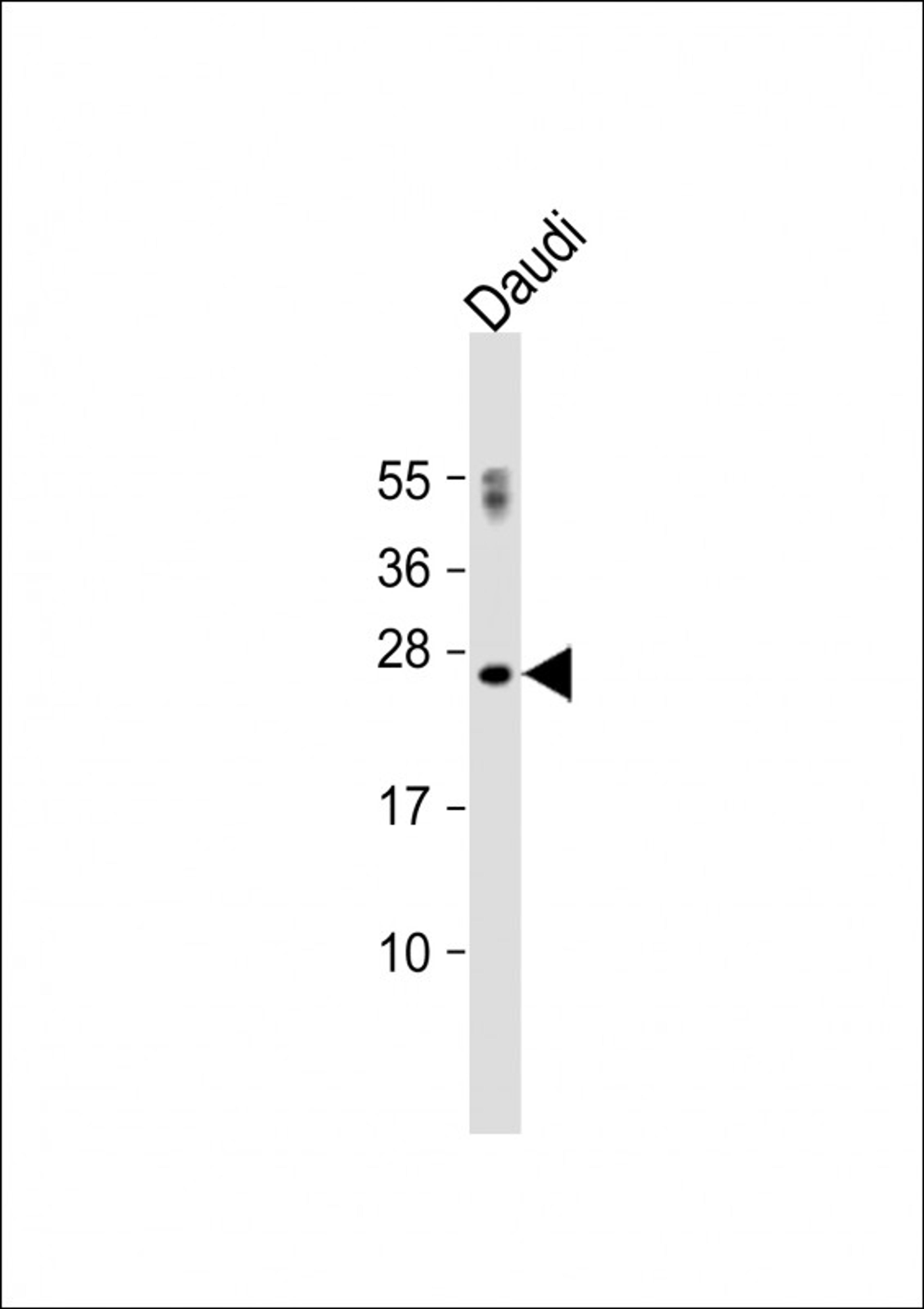 Western Blot at 1:500 dilution + Daudi whole cell lysate Lysates/proteins at 20 ug per lane.