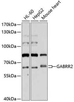 Western blot - GABRR2 antibody (A10111)